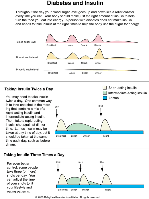 Diabetes and Insulin: Illustration