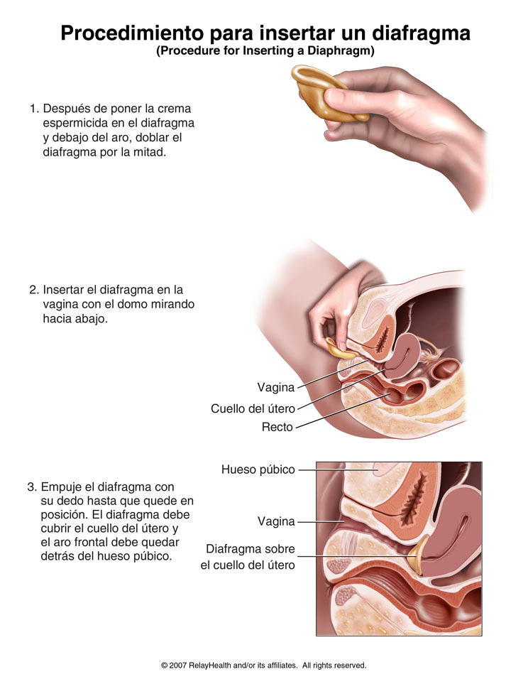 Diafragma: ilustración