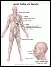 Thumbnail image of: Lymph Nodes and Vessels: Illustration