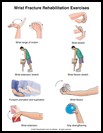 Thumbnail image of: Wrist Fracture Exercises: Illustration