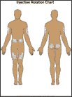 Thumbnail image of: Diabetes: Injection Rotation Chart