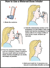 Thumbnail image of: Cmo usar un inhalador de dosis medida: ilustracin