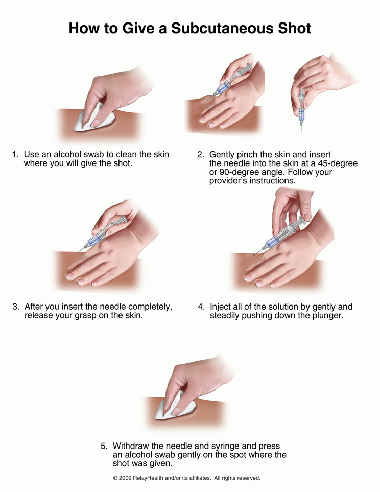 Subcutaneous Shot, How to Give: Illustration